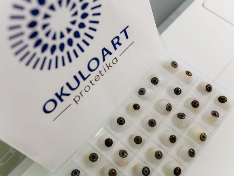 OKULOART – Individualna očna protetika